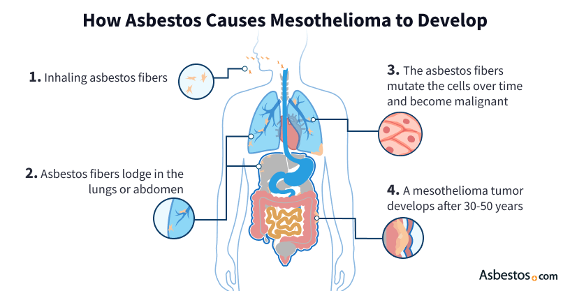 Can A Single Exposure To Asbestos Cause Mesothelioma?